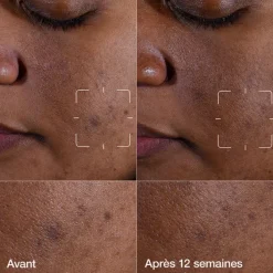 Clinique Sérum><noscript><img width=