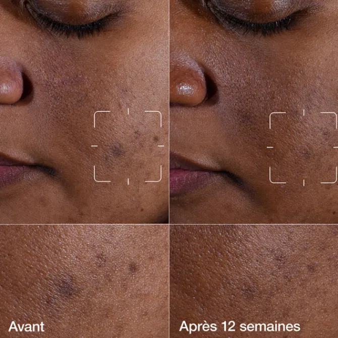 Clinique Sérum>Even Better Clinical™