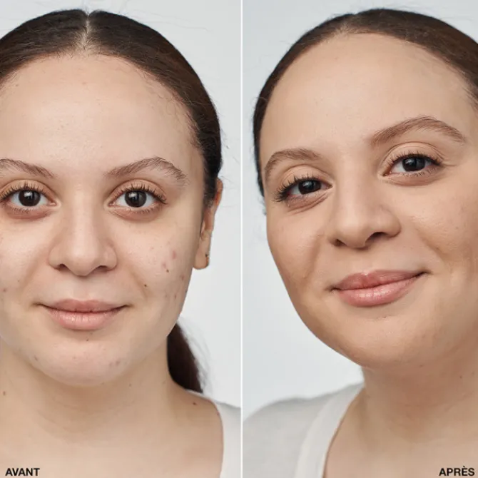 Clinique Fond De Teint Fluide>Even Better Clinical