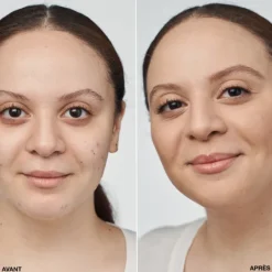 Clinique Fond De Teint Fluide><noscript><img width=