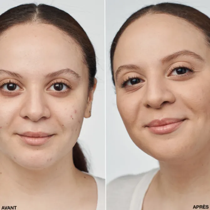 Clinique Fond De Teint Fluide>Even Better Clinical