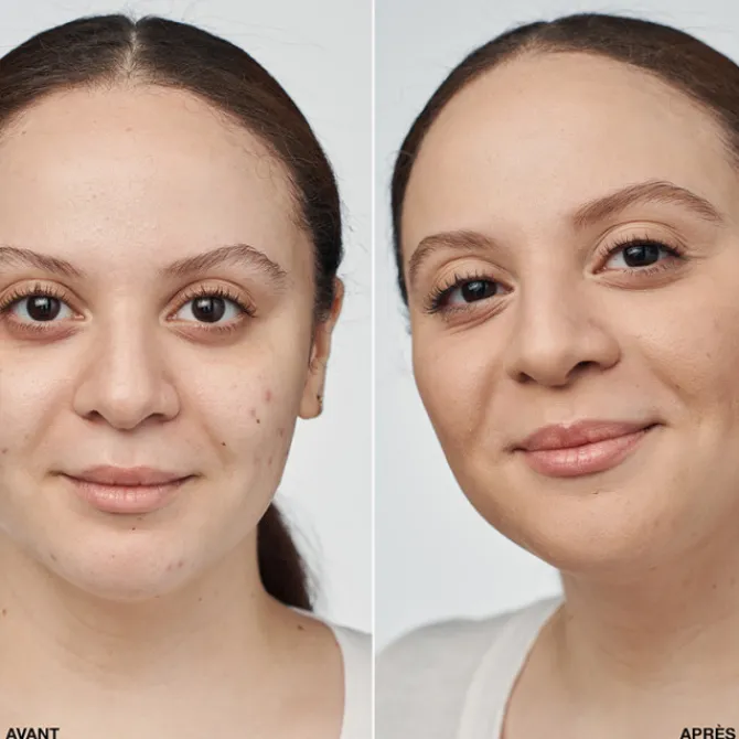 Clinique Fond De Teint Fluide>Even Better Clinical