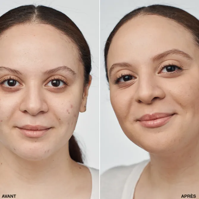 Clinique Fond De Teint Fluide>Even Better Clinical