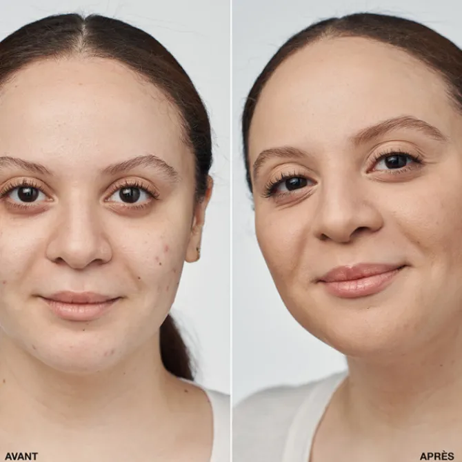 Clinique Fond De Teint Fluide>Even Better Clinical