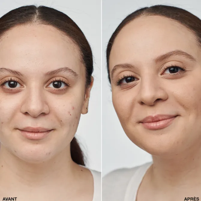 Clinique Fond De Teint Fluide>Even Better Clinical