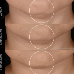 Lancome Crème De Jour><noscript><img width=