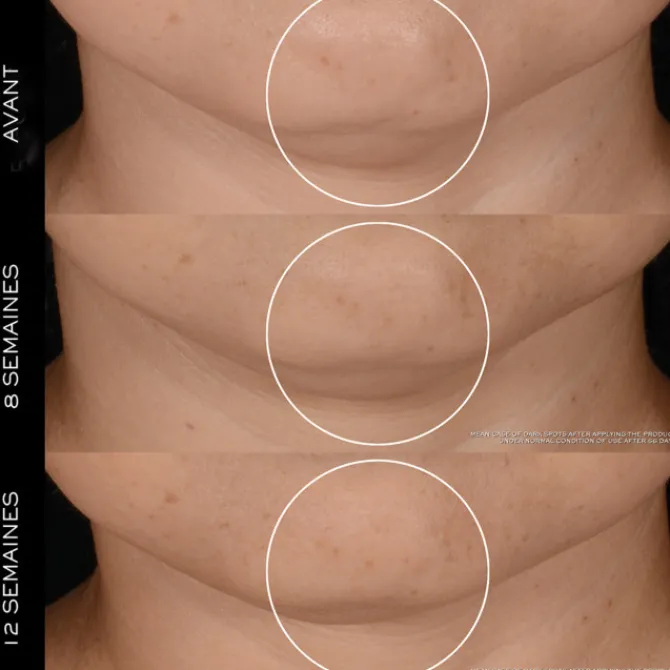 Lancome Crème De Jour>Rénergie H.P.N. 300-Peptide