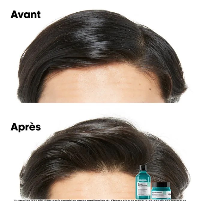L'Oreal Professionnel Cheveux Gras|Shampooing>Scalp Advanced