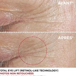 Clarins Soin Des Yeux & Lèvres>Total Eye Lift